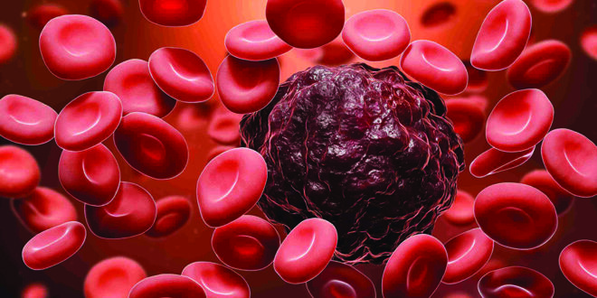دراسة: نجاح العلاج بـ «الخلايا المعدلة» في شفاء الأطفال من سرطان الدم