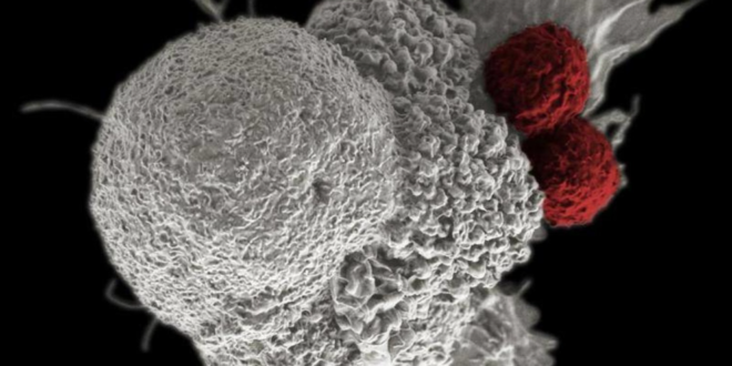 اكتشاف طريقة غير متوقعة لانتشار الخلايا السرطانية