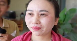 امرأة فيتنامية لا تعرف النوم منذ 11 عاما
