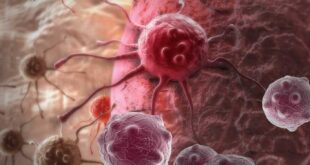 دراسة علمية تكشف آليات تأثير الخلايا السرطانية في الأنسجة السليمة المجاورة