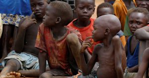 السودان.. سوء التغذية يفتك بأرواح الأطفال